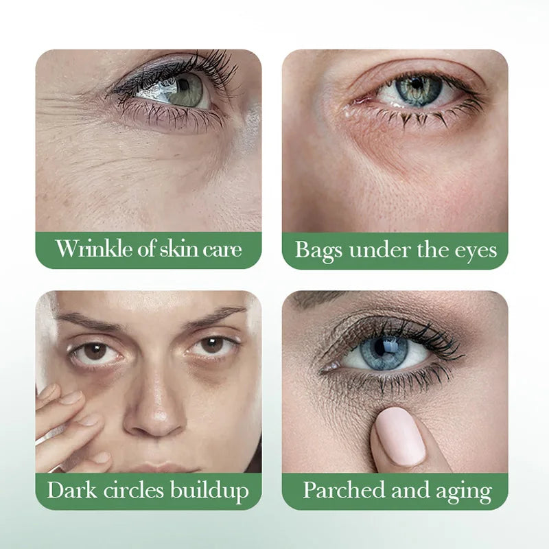 Centella Asiatica Eye Cream Anti Dark Circles Under the Eyes Remove Eye Bags Moisturizing Eyes Skin Care Products