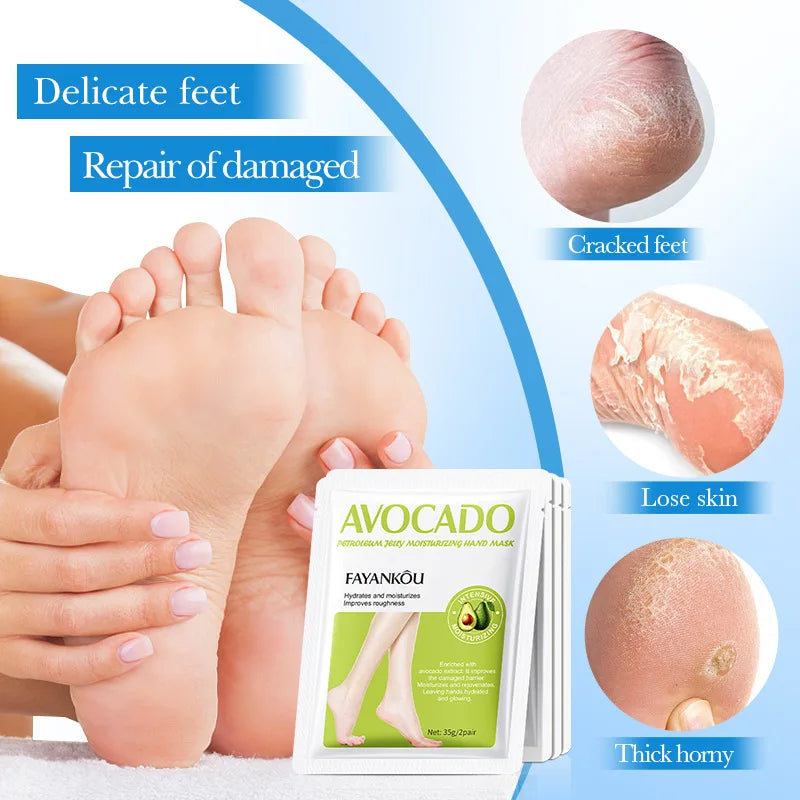 5 Pairs Avocado Exfoliating Foot Mask and Exfoliator